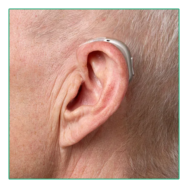 Bernafon Encanta 300 Engage miniBTE Oplaadbaar - On Ear Male | Oogvoororen