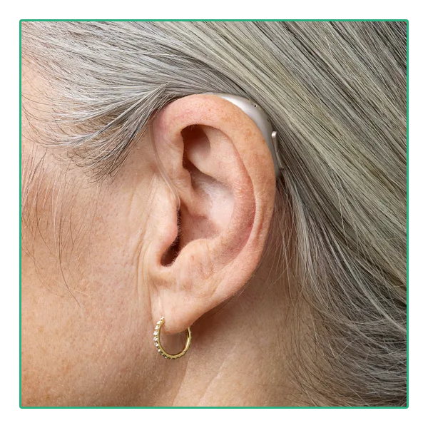 Bernafon Encanta 300 Engage miniBTE Oplaadbaar - On Ear Woman | Oogvoororen